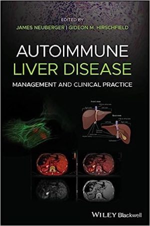 Autoimmune Liver Disease Management and Clinical Practice