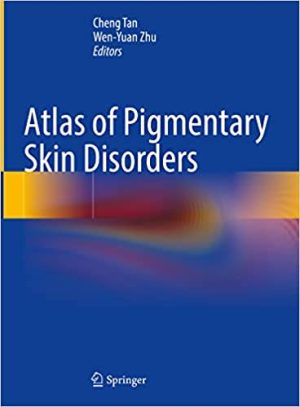Atlas of Pigmentary Skin Disorders