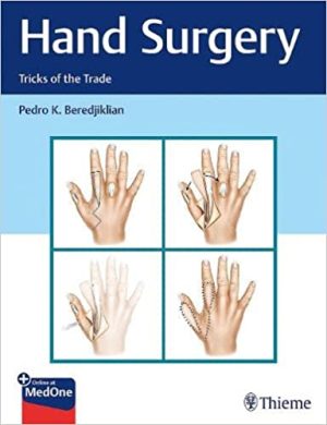 Hand Surgery Tricks of the Trade