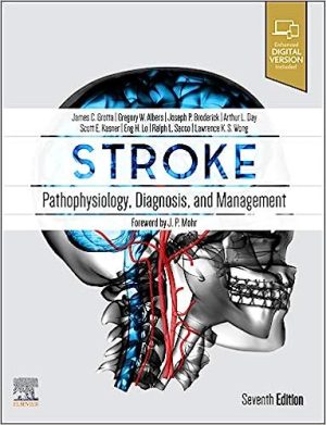 Stroke Pathophysiology Diagnosis and Management