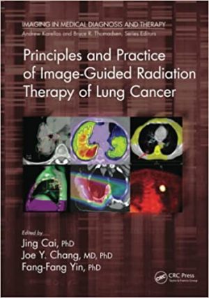 Principles and Practice of Image Guided Radiation Therapy of Lung Cancer
