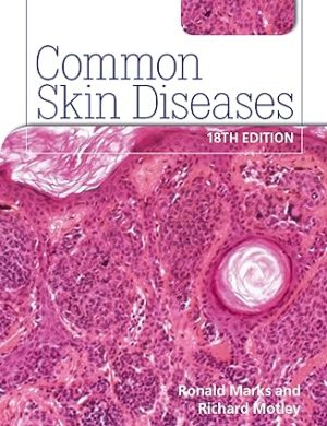 Common Skin Diseases 18th edition ISE 18th Edition